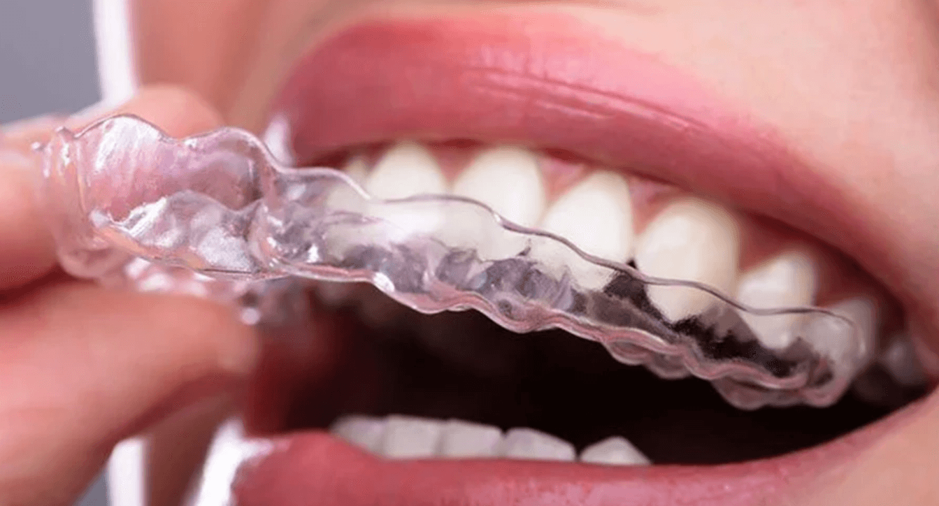 Orthodontic Services for Straightening Teeth and Smiles